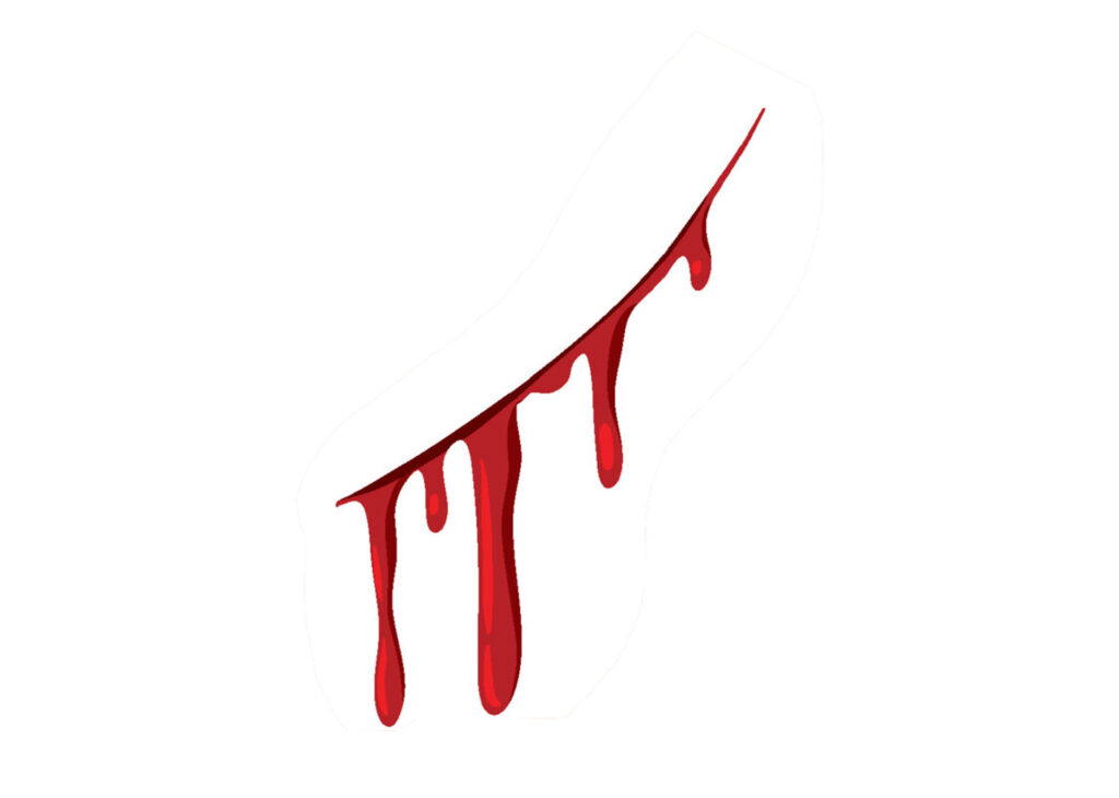 Sangue estancado